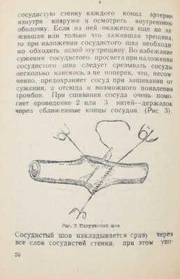 Крымов А.П. Огнестрельная аневризма. Челябинск: Медгиз Наркомздрава СССР, 1943.
